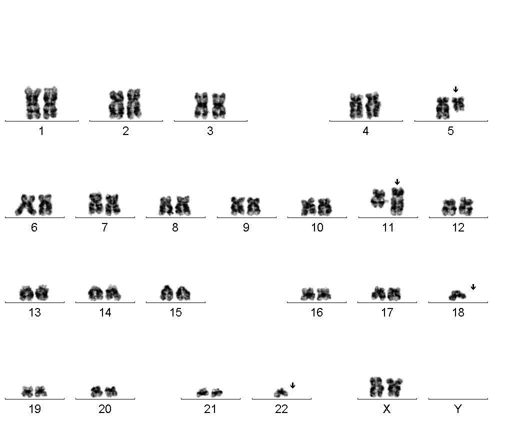 G-banding